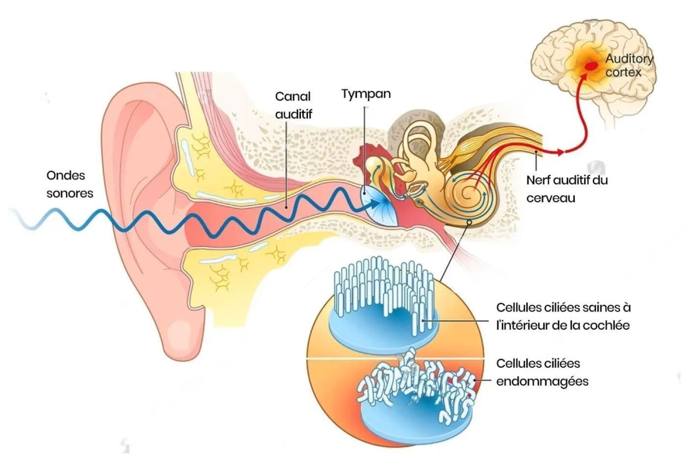 Illustration d’article